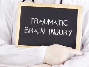Home Care Indian Land SC - When Should You Seek Emergency Care for a Senior Who Has Suffered a Concussion?